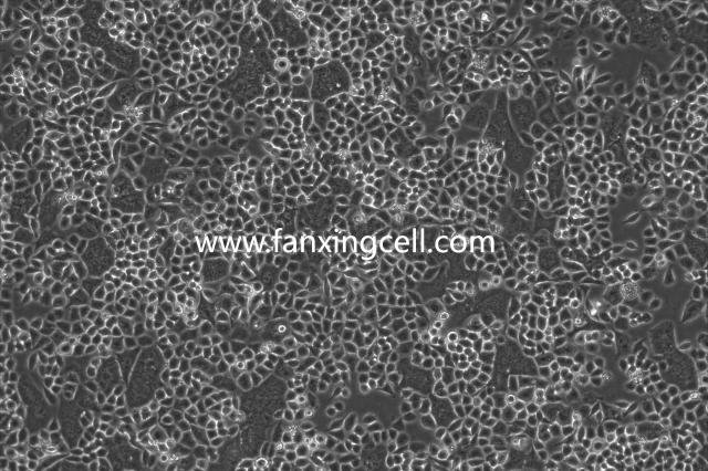 HCT-8 人结肠腺癌细胞