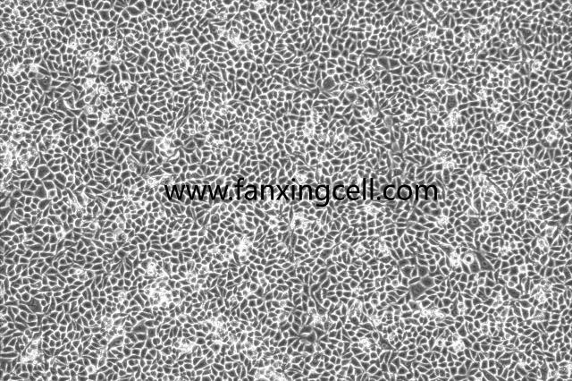 RKO 人结肠腺癌细胞